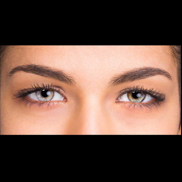 ohne Wonderstripes Nahaufnahme von Augen mit Lifting-Effekt nach Anwendung